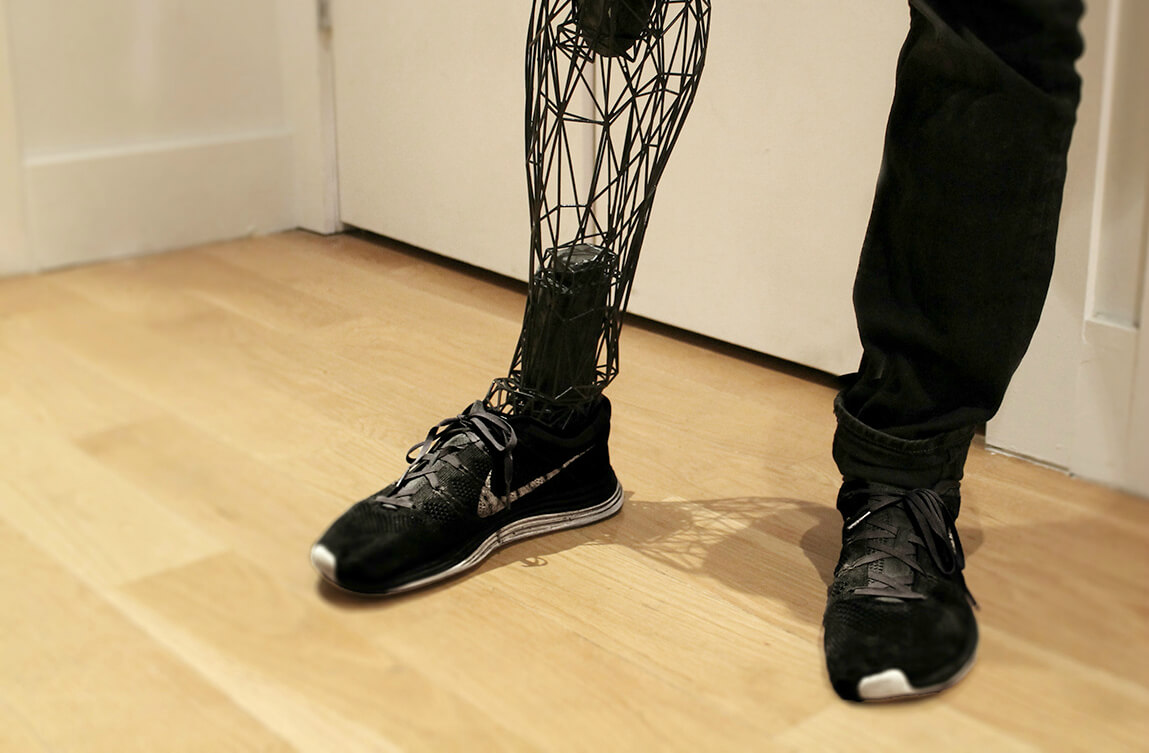 exo 3d printed prosthetic (2)