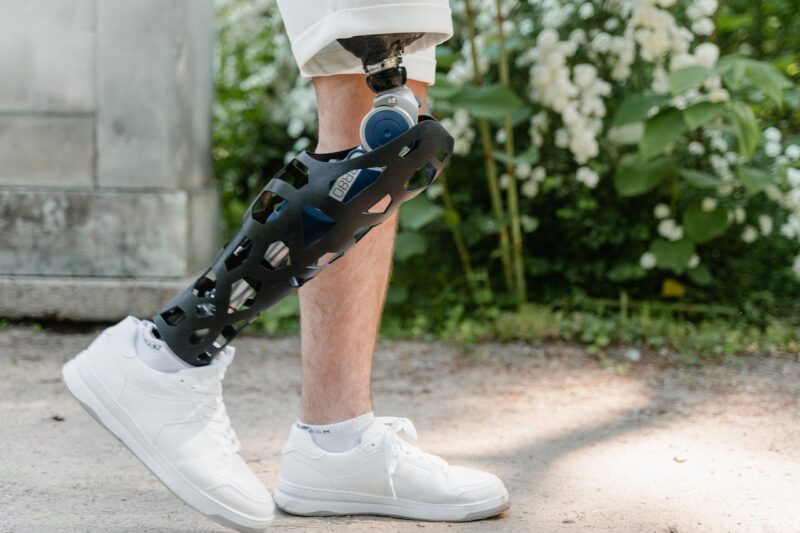 The Economics Of Prosthetics: Affordability And Accessibility | OP Centers