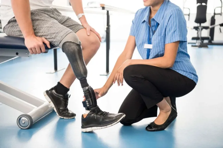 Amputation Rehabilitation Downtown Edmonton InStep® Physio (1)