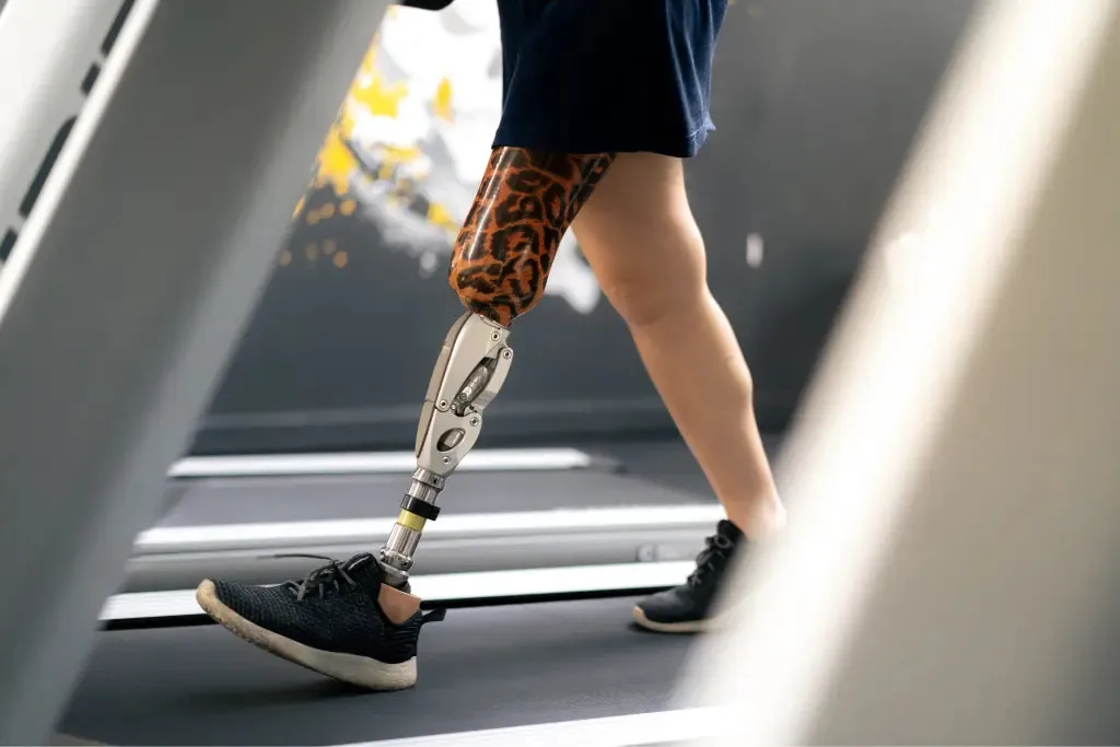 65a0e67fa7f31491b09540ee can you run with a prosthetic leg