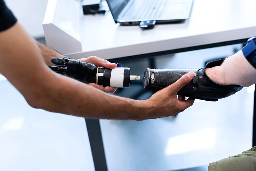 Arm Prosthetics Insights for Better Independence in Life.