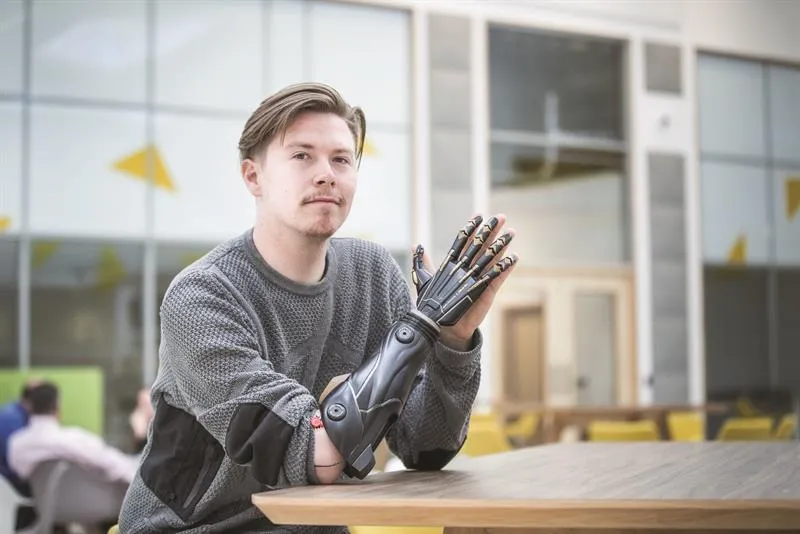 arm prosthetics