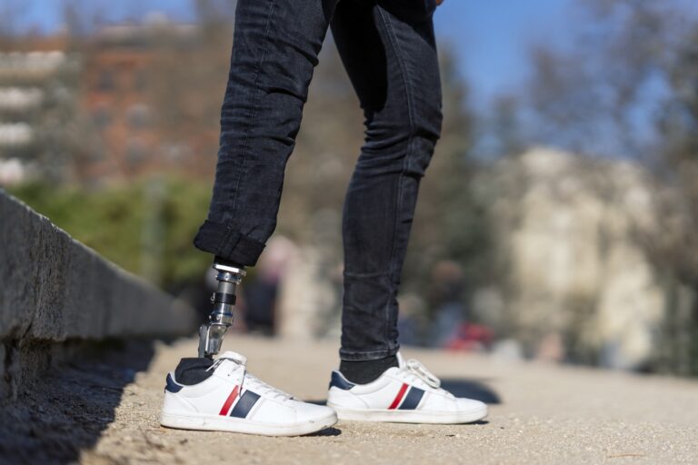 Blog 142 closeup shot disabled young man with foot prosthesis sitting outdoor