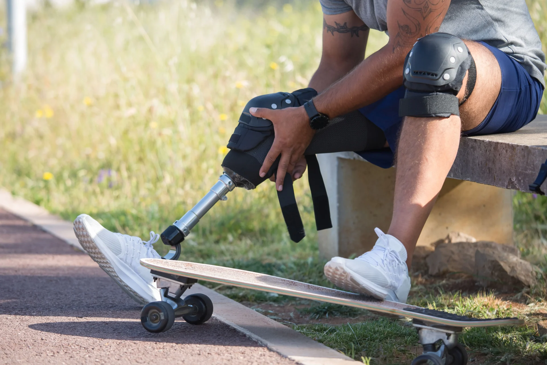 Prosthesis Replacement Insurance